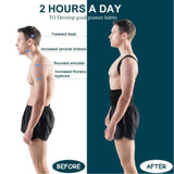Back Brace Posture Corrector for Women & Men,Back Straightener, Scoliosis and Hunchback Correction,Adjustable Posture Trainer - MisteryBox